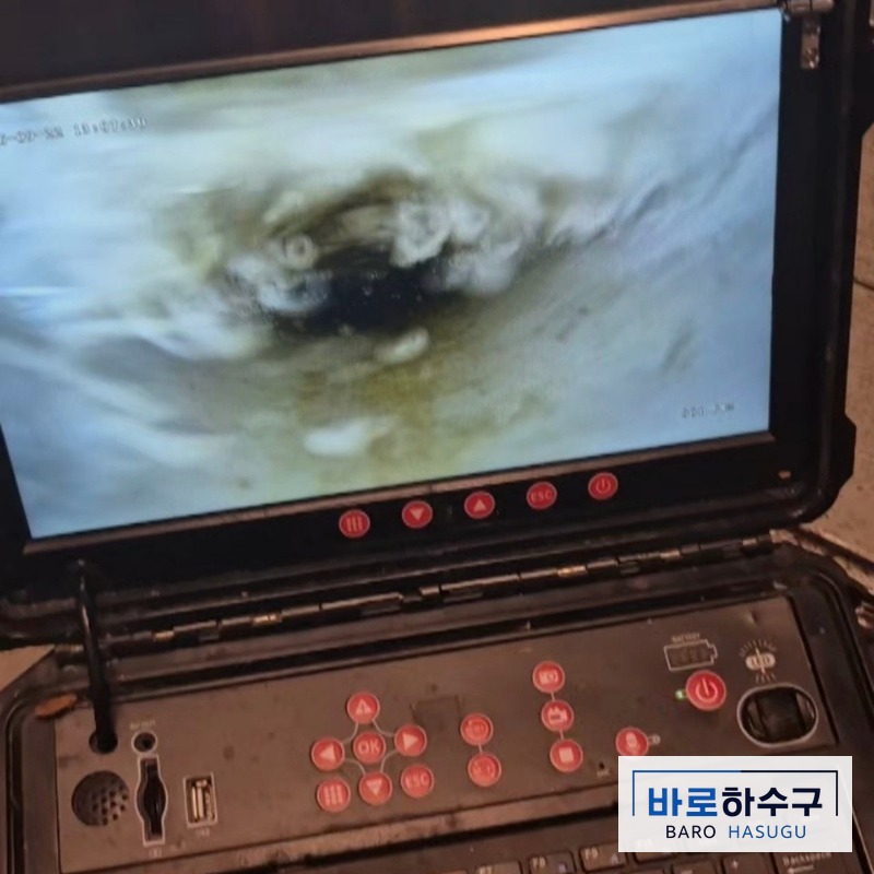 수원시 스케일링 뒤 다시 넣은 내시경 화면